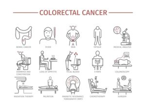 colon cancer symptoms and diagnosis