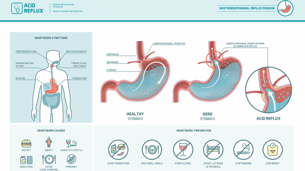 Acidity Acid Reflux Food Chart