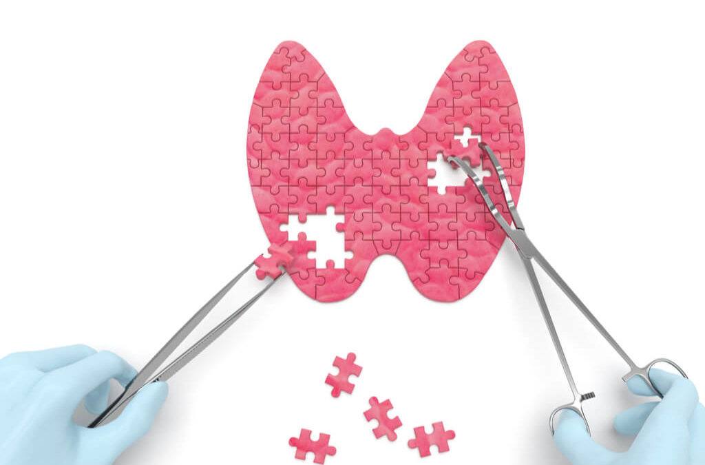 No scar thyroid surgery at TSC Rutherford uses endoscopic tools to remove the thyroid.