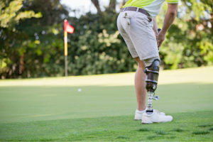 Man with a prosthetic leg playing golf