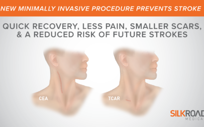 Patient’s Guide To Trans-Carotid Artery Revascularization