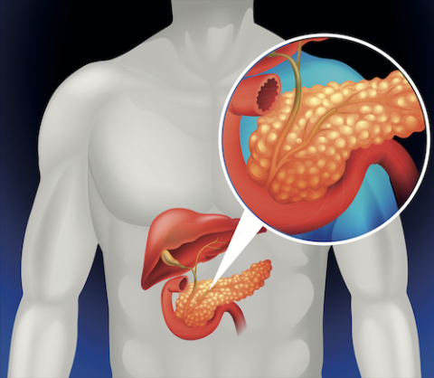 Hepato-Pancreato-Biliary Surgery & the Pancreas in Nashville