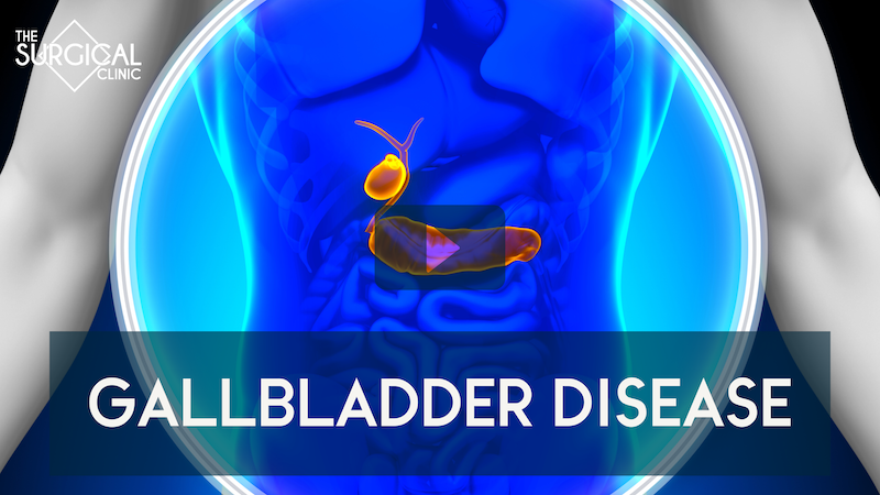 gallbladder disease treatments in nashville