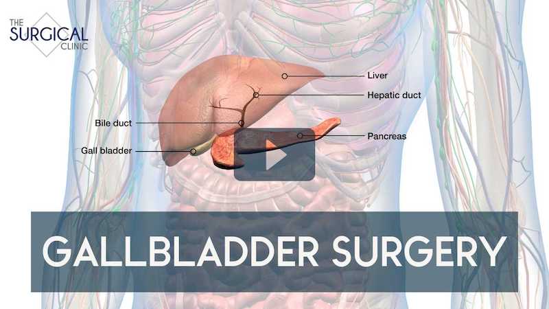 gallbladder removal in nashville
