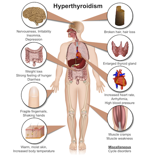 Thyroid Disease 20 Symptoms The Surgical Clinic