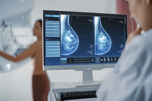 breast scan for a breast surgeon and plastic surgeon to view
