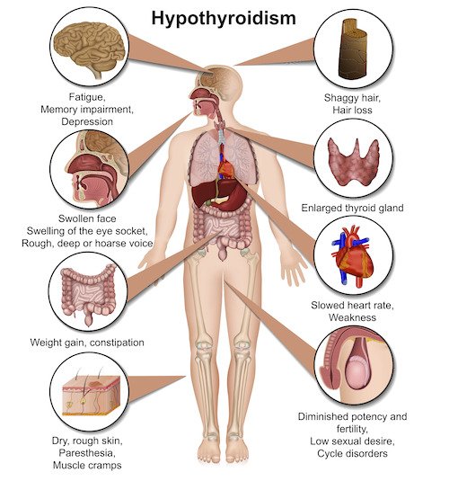 thyroid-disease-20-symptoms-the-surgical-clinic