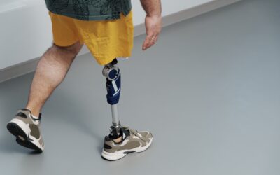 How Advanced Prosthetics Can Improve Quality of Life
