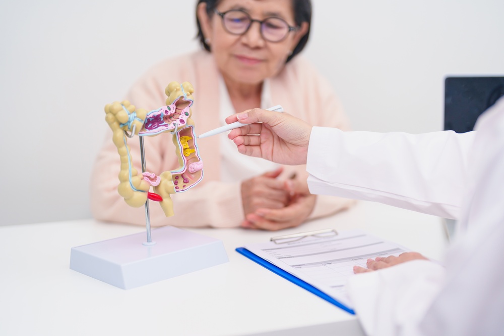 Doctor using a colon model to explain diverticulitis to an older patient